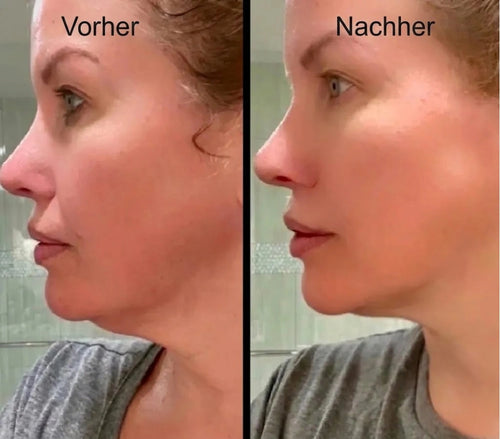 Skulpt Lymphatic Sculpting Facial Brush