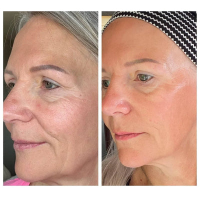 Skulpt Lymphatic Sculpting Facial Brush